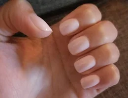 Beaux Ongles De Kim