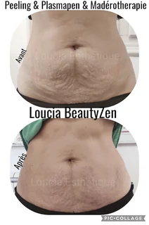 Photo LOUCIA Beauty-Zen ESTHETIQUE